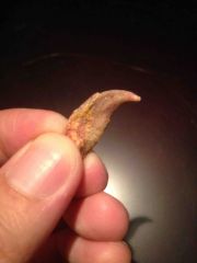 Pterosaur Wing Claw