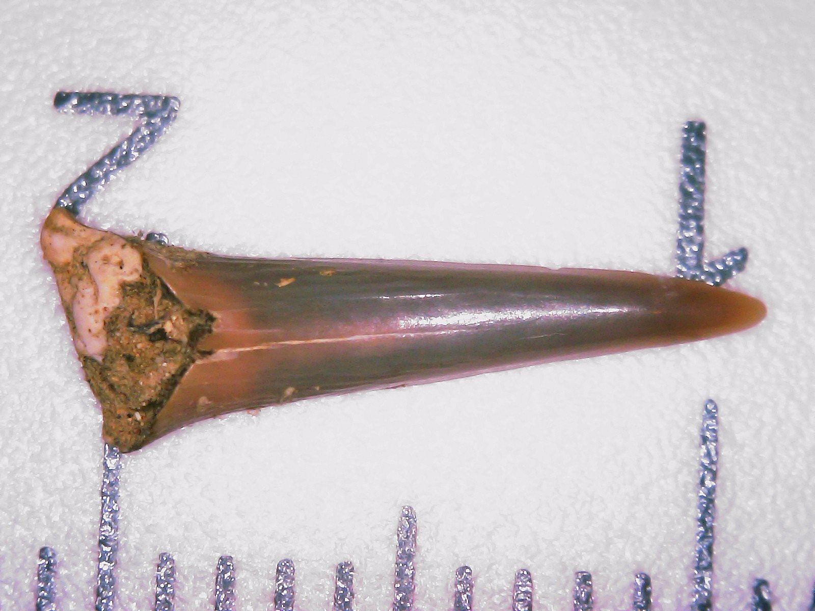 Tooth 25