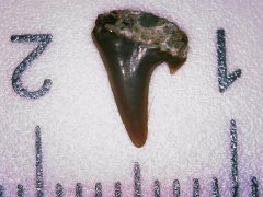 Tooth 1