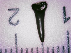 Tooth 7
