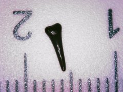 Tooth 14