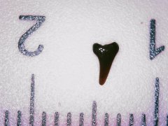 Tooth 18