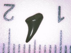 Tooth 32