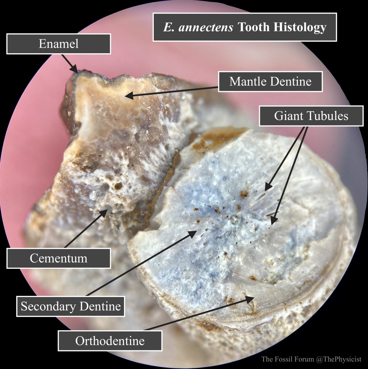 Edmontosaurus tooth histology