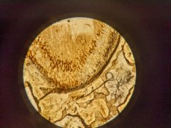 Glomites rhyniensis hyphae in the cortex of Aglaophyton major