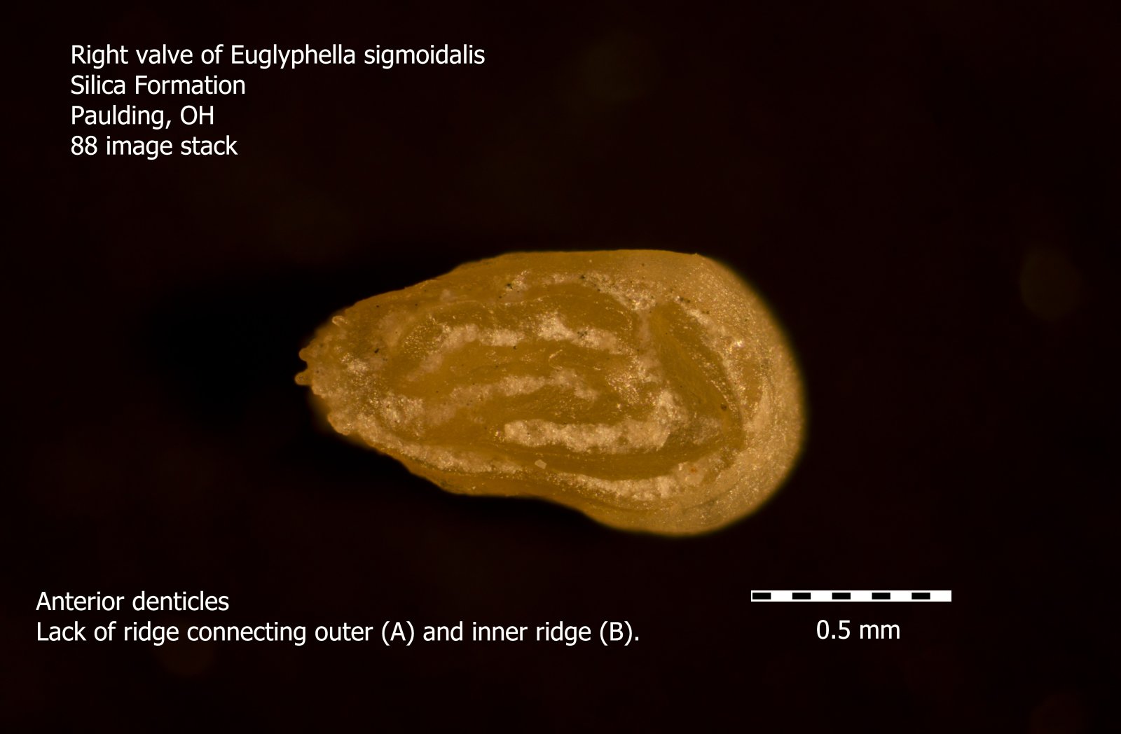 Euglyphella sigmoidalis.jpg